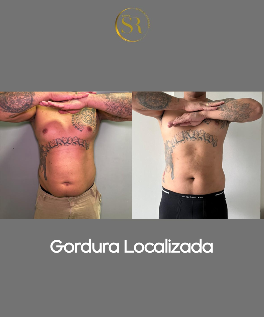 Texto do seu parágrafo (2)